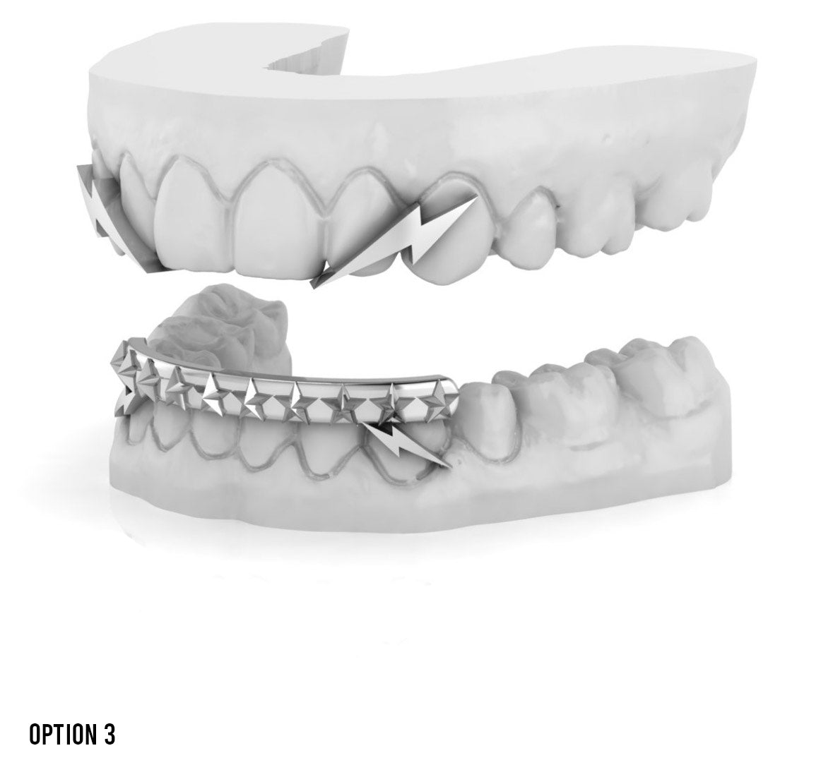 Yelawolf VIP Grillz Experience