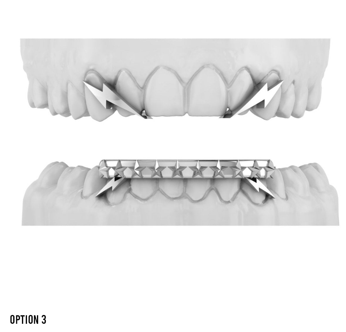 Yelawolf VIP Grillz Experience